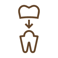 詰め物・被せ物